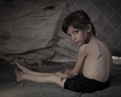 gaza hunger death